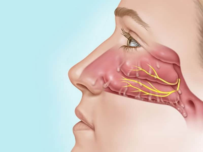 Острый катаральный ринит. Аллергический ринит слизистая носа. Воспаление слизистой носа.